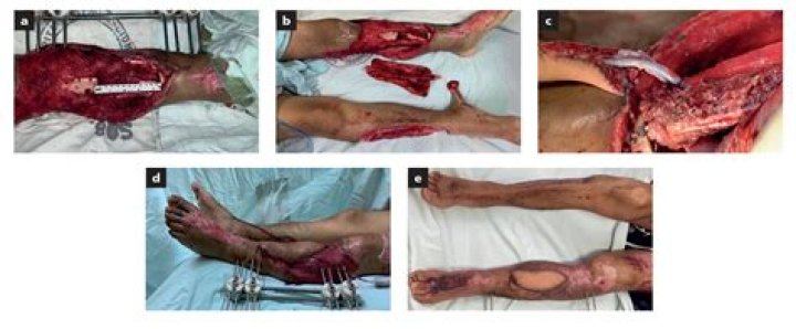 Video no muestra aplastamiento de personas en hospital de Gaza